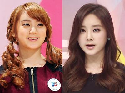 Lama Tak Muncul, Hyelim Wonder Girls Dirumorkan Operasi Plastik